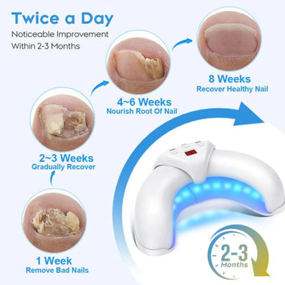 Nail Fungus Laser Treatment Device