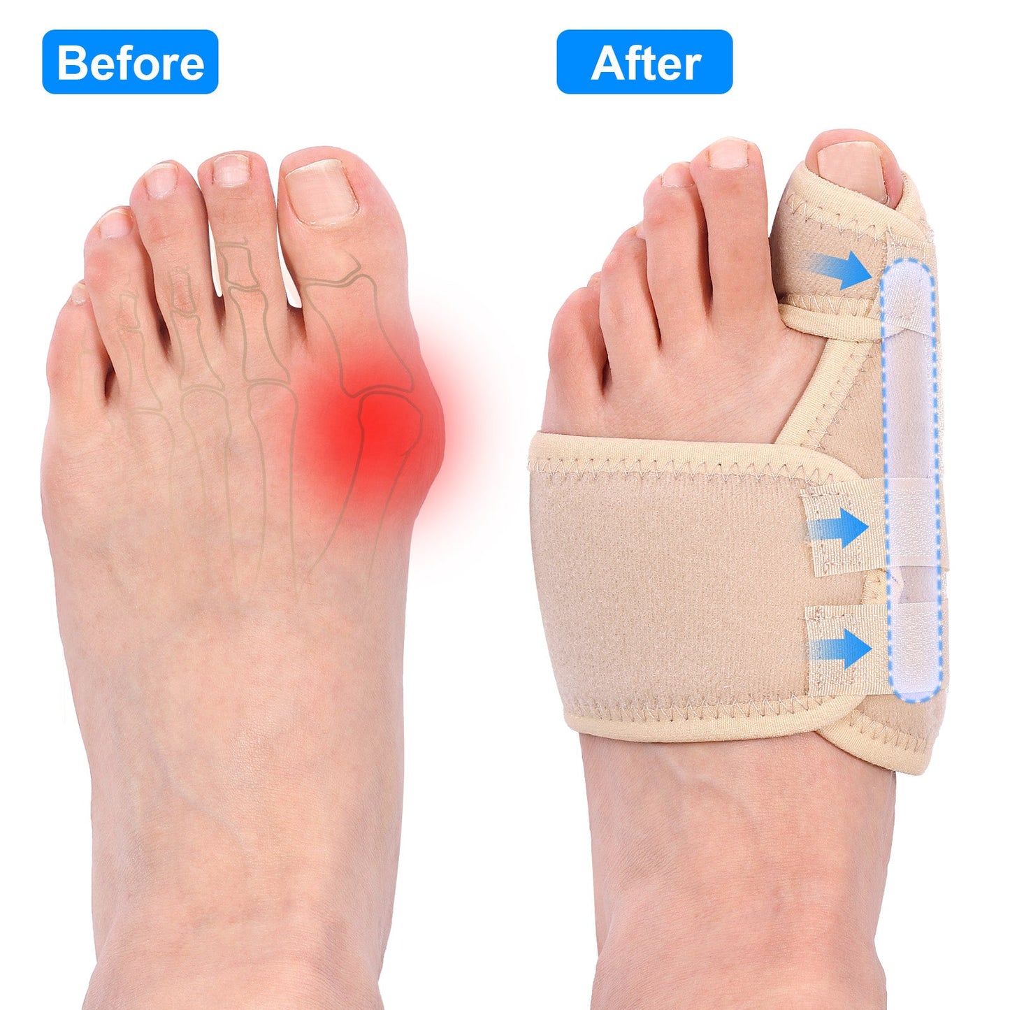 Adjustable Ankle Support Wrap for Bunion Relief - 1 Piece